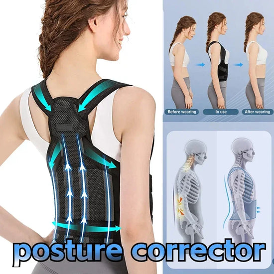 Align Pro™ Posture Corrector – Adjustable Back Support Brace for Better Posture & Pain Relief
