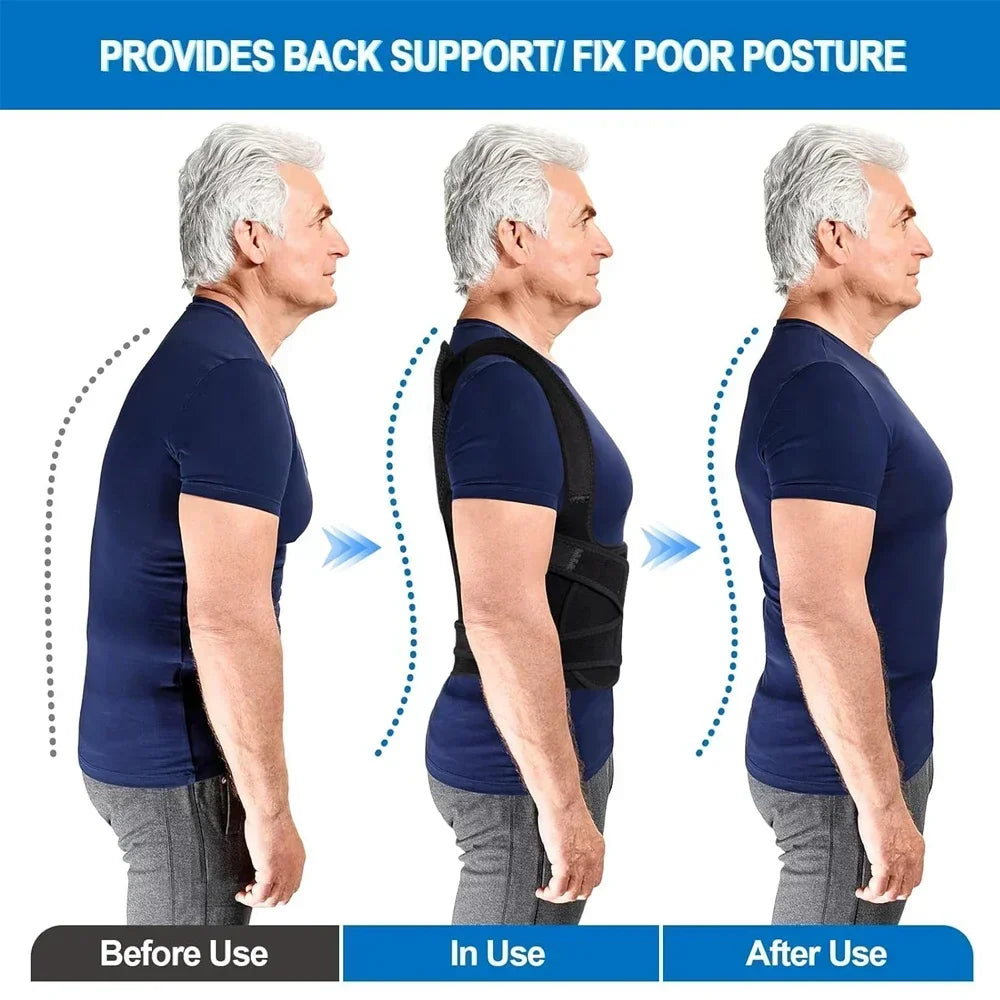 Align Pro™ Posture Corrector – Adjustable Back Support Brace for Better Posture &amp; Pain Relief