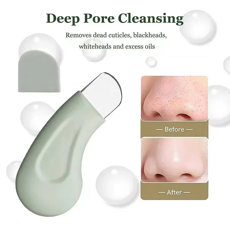 Blackhead and Whitehead Removal Tool for Nose and Face