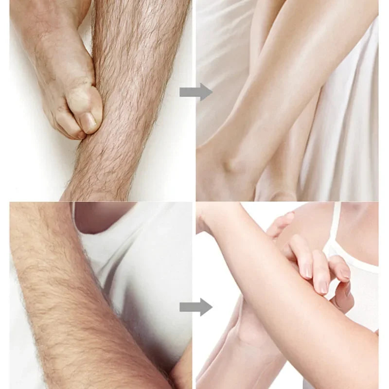 20stick Professional Hair Removal Wax Strips for Summer Depilation Double Sided Cold Wax Paper for Leg Body Face