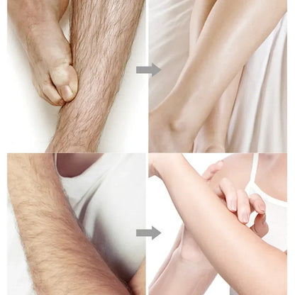 20stick Professional Hair Removal Wax Strips for Summer Depilation Double Sided Cold Wax Paper for Leg Body Face